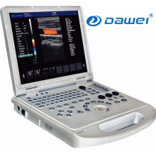 Windows 7 Plattform 4D Farb Doppler Laptop Ultraschall Scanner &amp; 3D Doppler Scanner